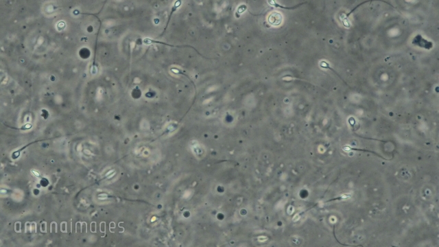 ヒトの精子 光学顕微鏡 動画素材 映像素材 アマナイメージズ