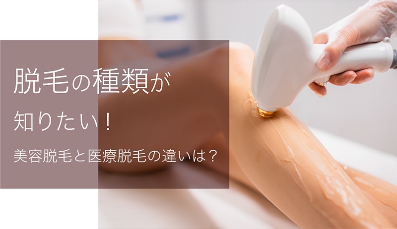 脱毛にはどんな種類がある?光脱毛や医療脱毛の方法やメリット、デメリットを紹介!