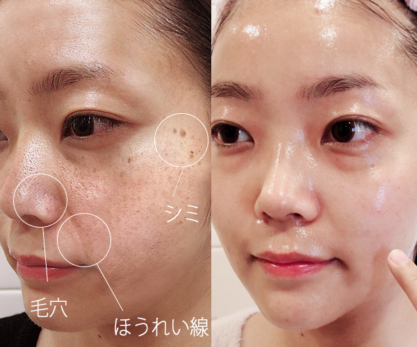 ビタブリッド 芸能人 モデルの必需品 シミ シワ 毛穴をなくす最強美白パウダーって