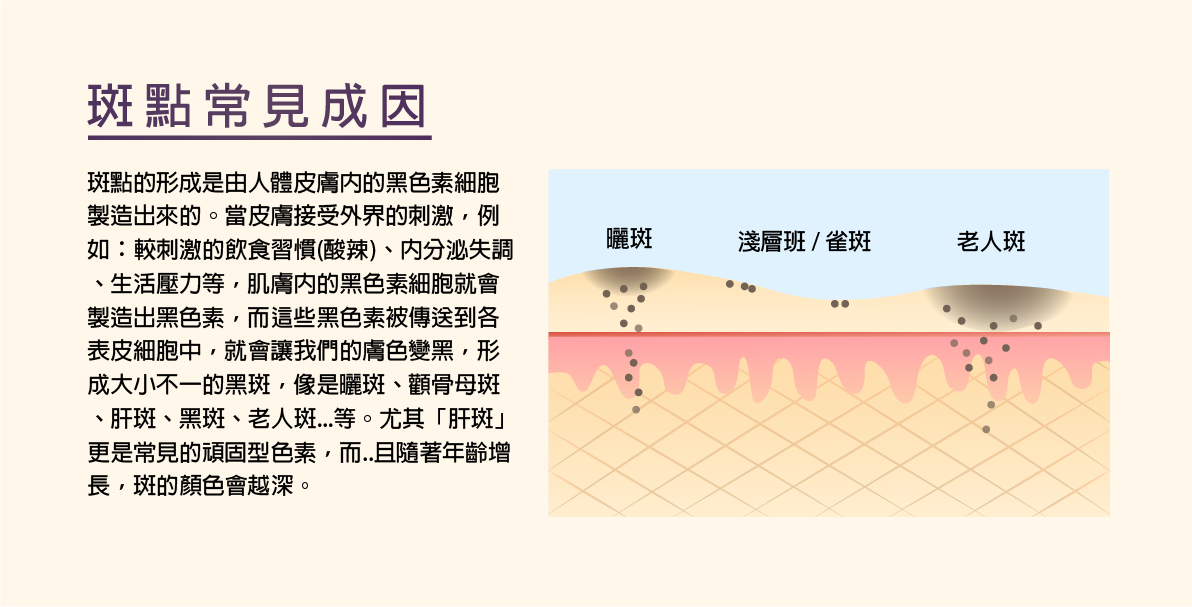 飛梭雷射,淨膚雷射.杏仁酸,保濕,清痘痘,縮毛孔,淡斑 飛梭雷射,微點飛梭雷射,凹洞,皺紋,疤痕,痘疤,磨皮,毛孔粗大,生長紋,細血管絲,色素不均,飛梭,凹疤