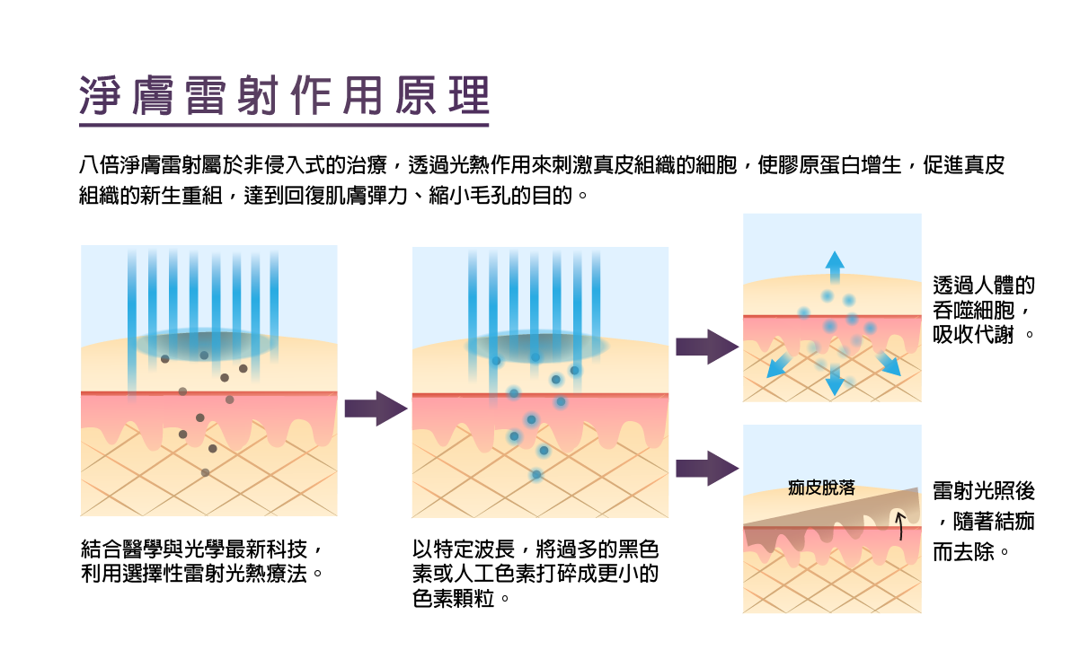 高雄微整形,淨膚雷射,除斑,膚色不均