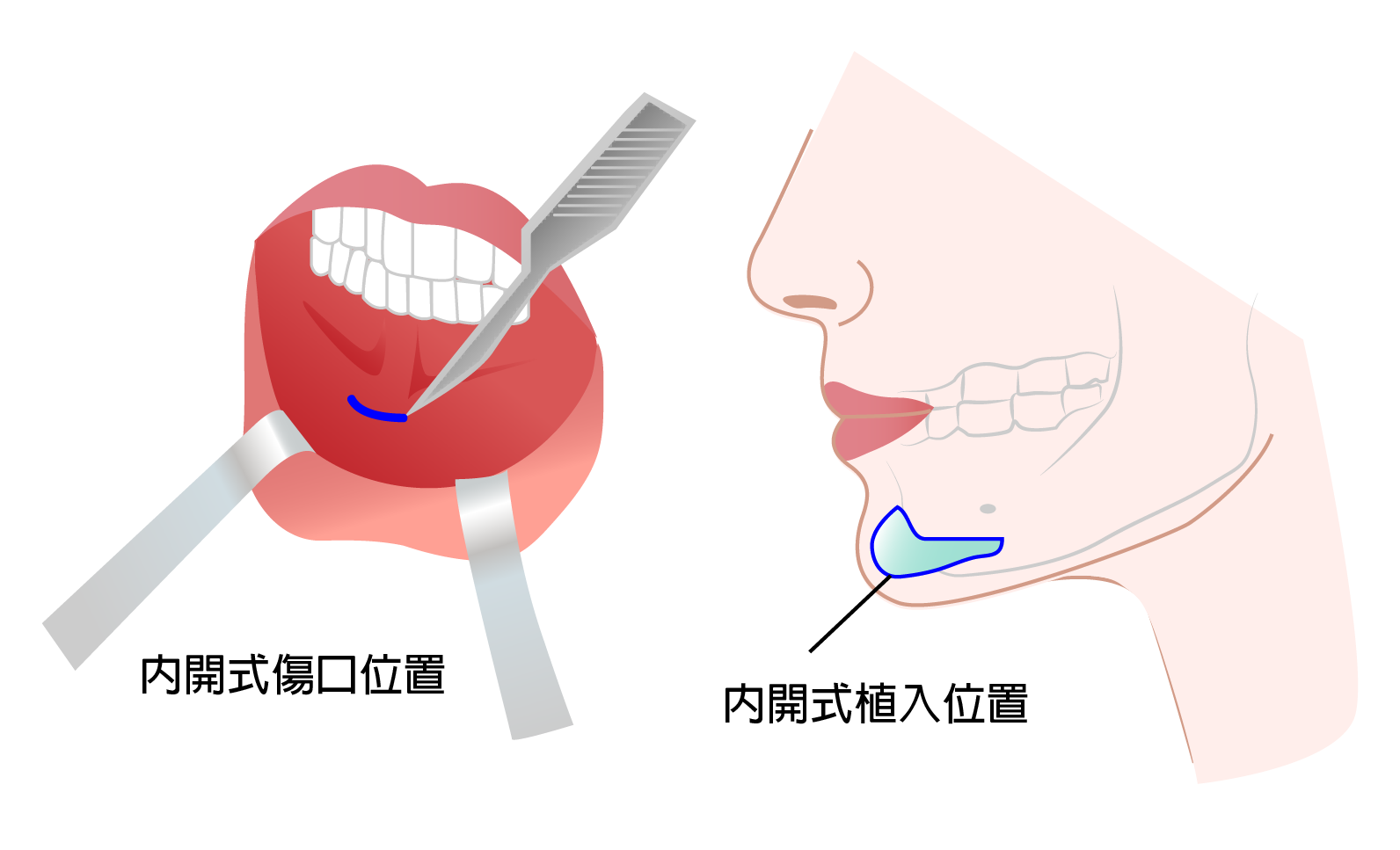 高雄整形,高雄醫美專業於,抽脂,雙眼皮,眼袋,隆乳,拉皮,隆鼻,墊下巴,微整,雷射以及美容保養