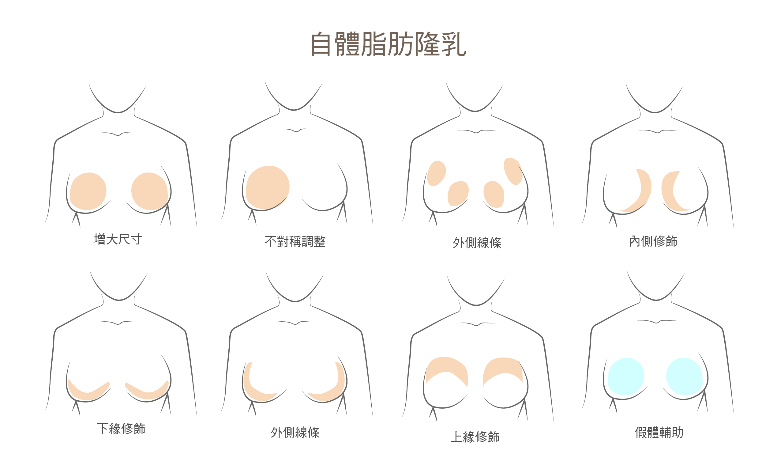 高雄醫美,高雄自體脂肪隆乳,高雄抽脂.高雄隆乳推薦