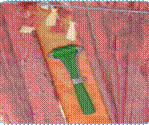 image022.gif
