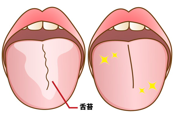 舌苔