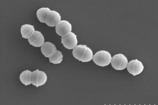 「人食いバクテリア」の原因となる細菌・A群溶血性レンサ球菌