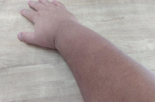 ヒトの皮膚。チンパンジーやヒヒと比べると体毛が少ない