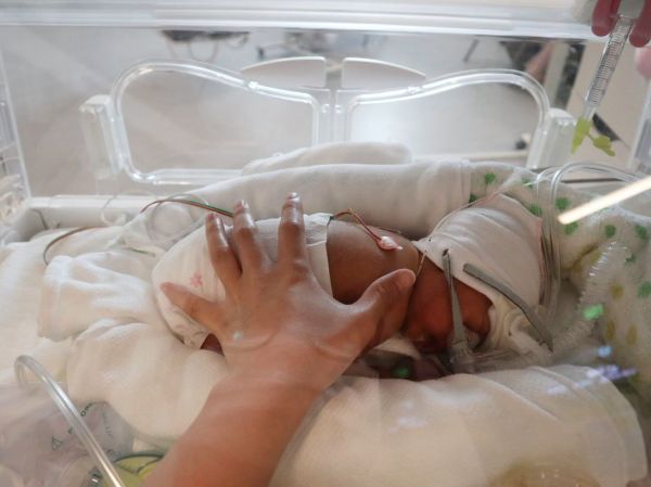 生後2カ月のころの次女。妊娠25週772gで生まれ、NICUに入院していました