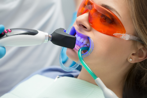 Tooth filling ultraviolet lamp
