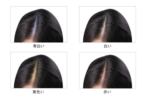 頭皮のケアは美髪にも効果あり Sandalphonジャーナル