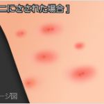 ダニに刺されるとかゆみや腫れが。虫刺されと同様症状があります。のサムネイル画像