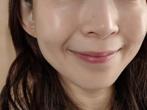 【薬剤師が解説】ほうれい線の原因と対策とは？おすすめグッズも紹介