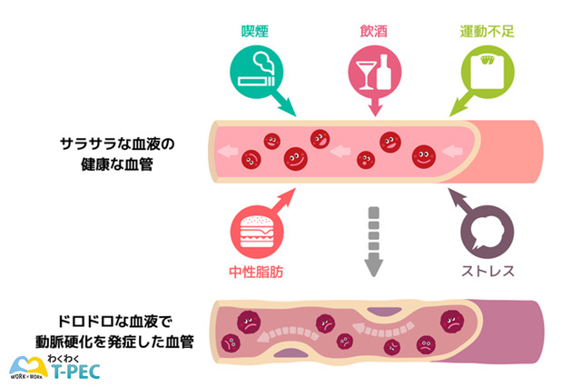 血管(サラサラ血液とドロドロ血液)