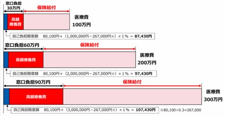 図表2　70歳未満・年収約370万円～約770万円の場合（3割負担）