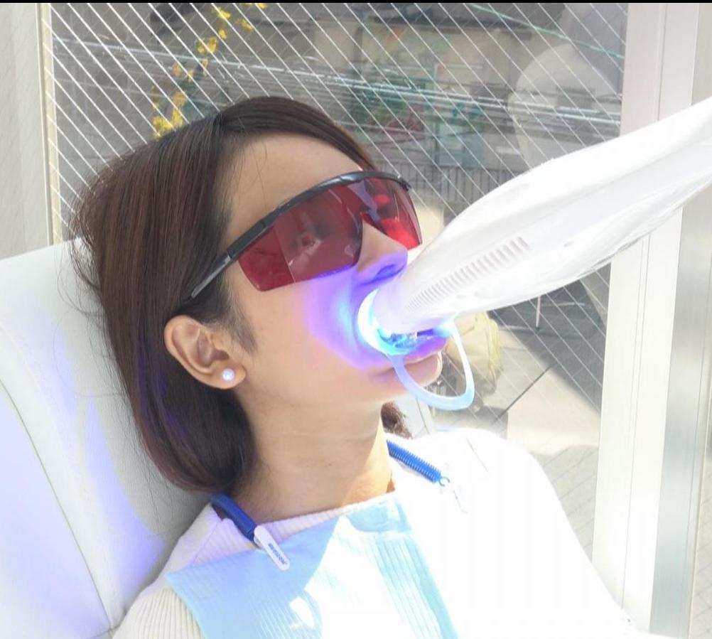 歯のホワイトニングもスタートのイメージ