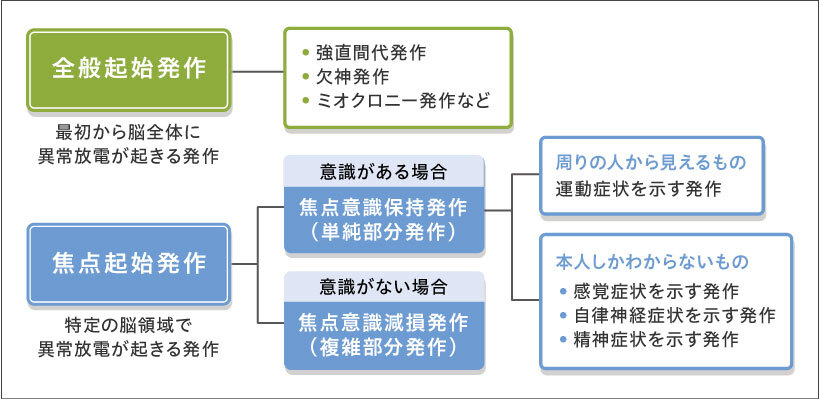 大人にもおこるてんかんとは 症状や原因 発作の種類って 自分のてんかんを理解しよう Litalicoワークス