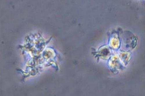 (Dendritic cells obtained from iPS cells, provided by Wakayama Medical University)