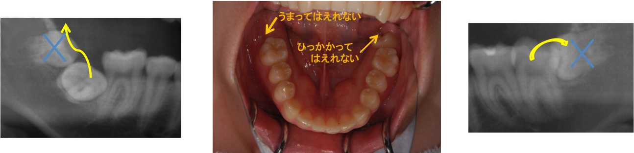maihuku_11