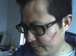 郭飞雄挨打