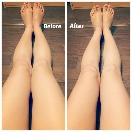 いとこ 悪質な 開いた メディキュット 痩せる Ths Troyoh69 Org