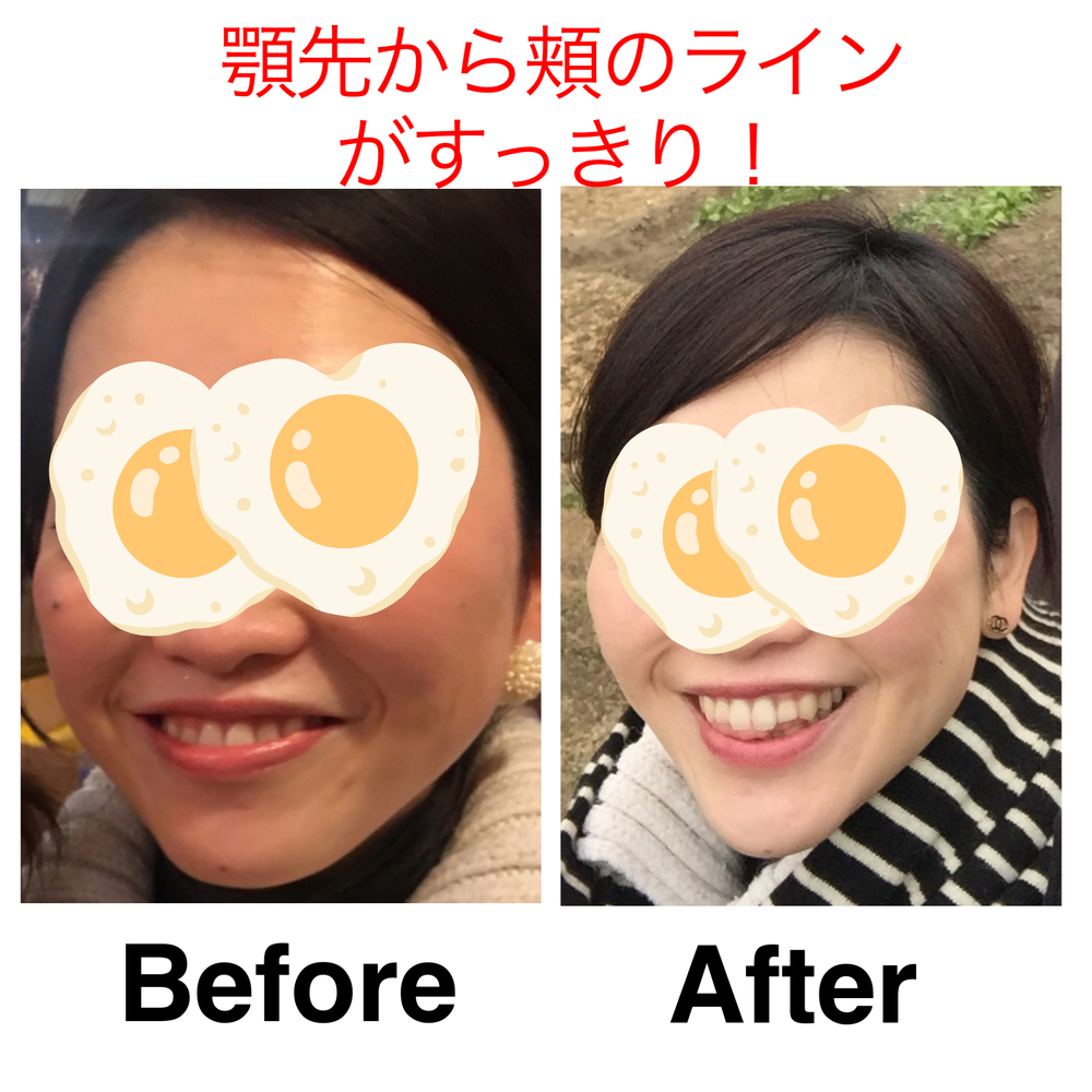 647452d95549fc11
