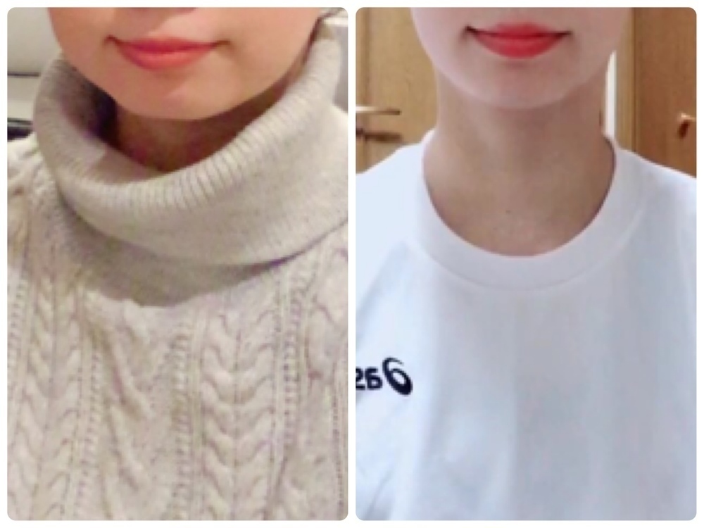91d52fc8620db08d