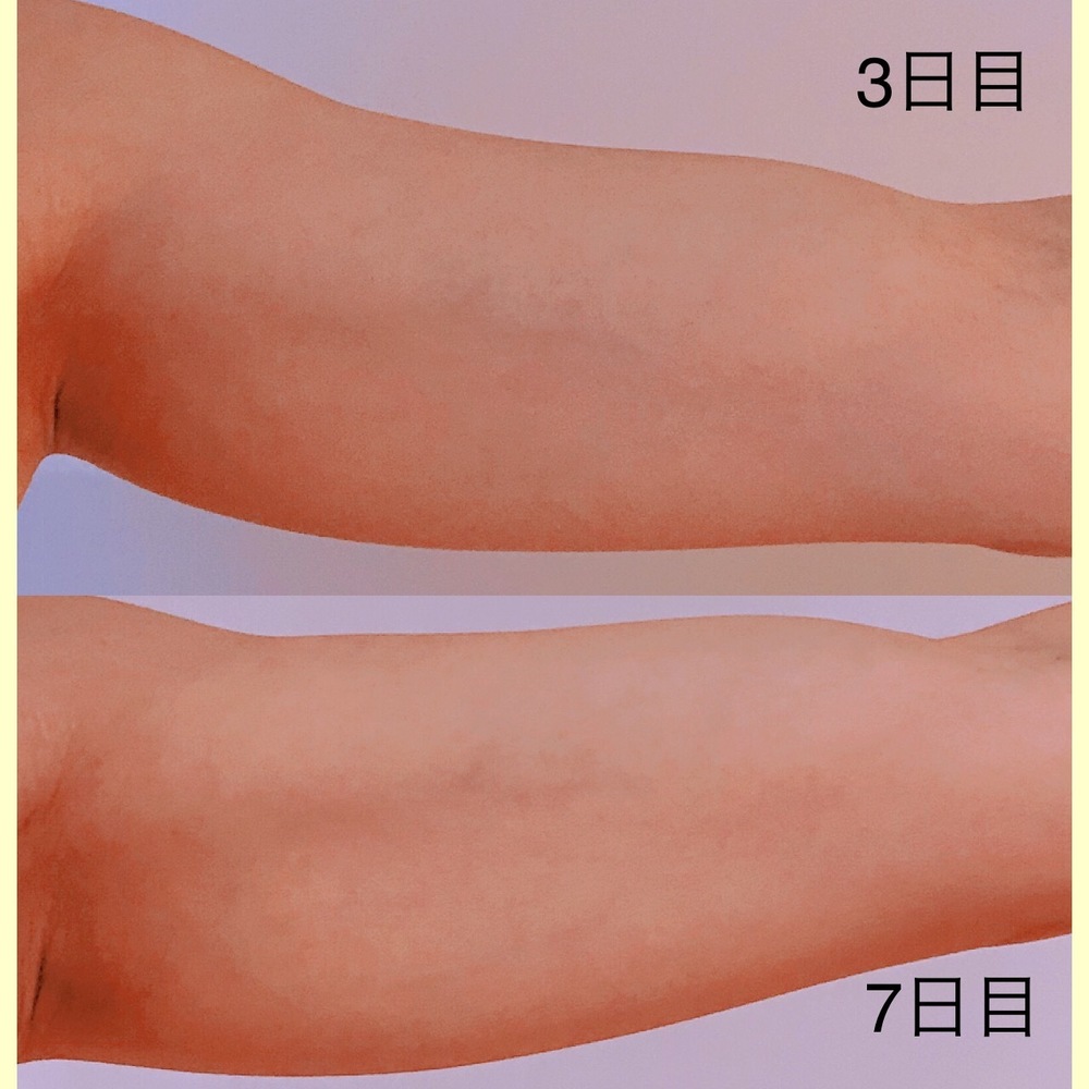 7bf7e82c4bcd954f