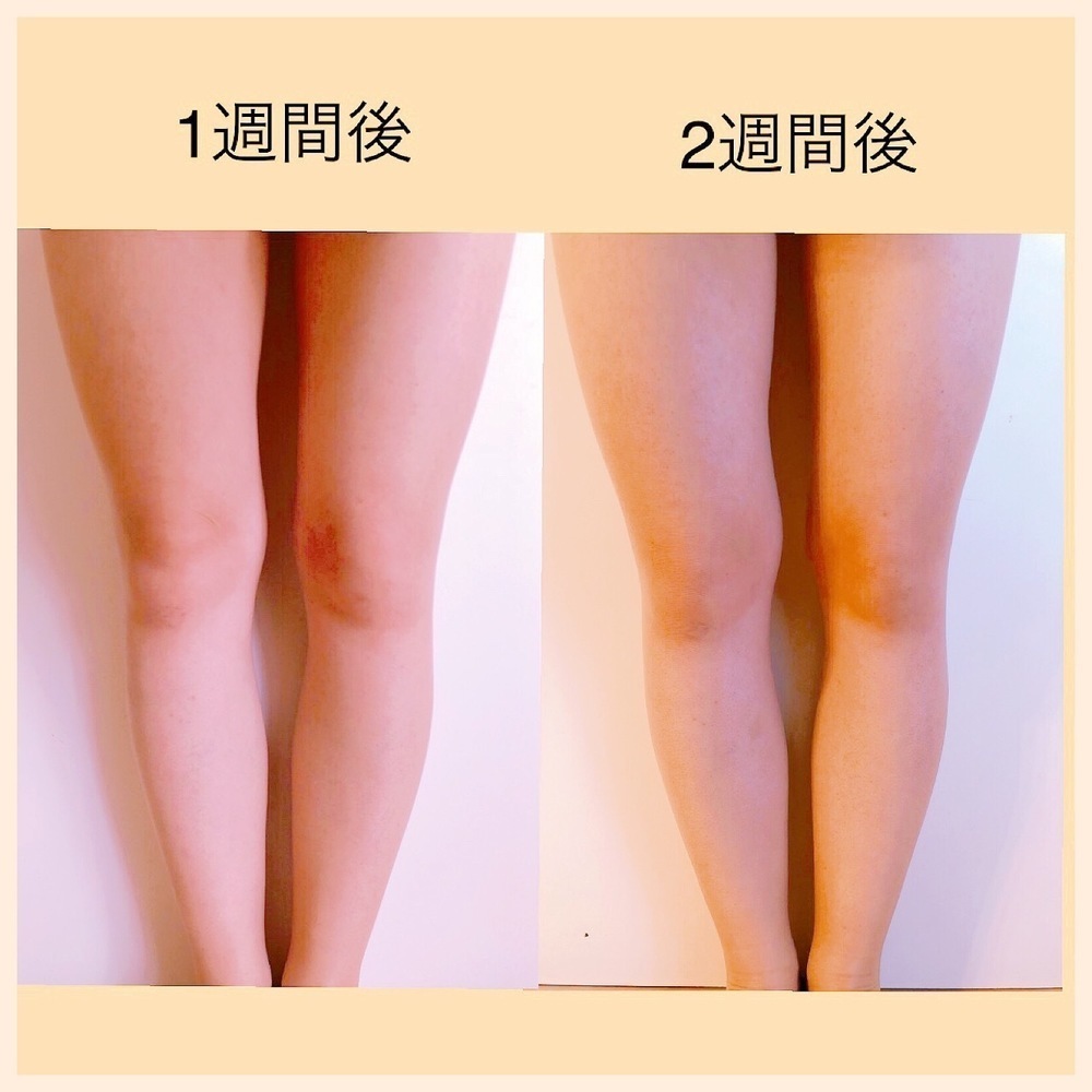 8a6b1403051dac31
