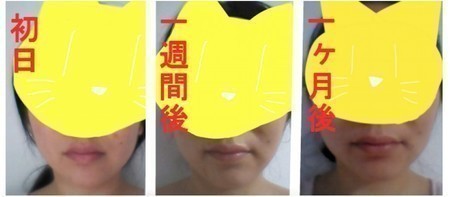 10102635f5724fe8