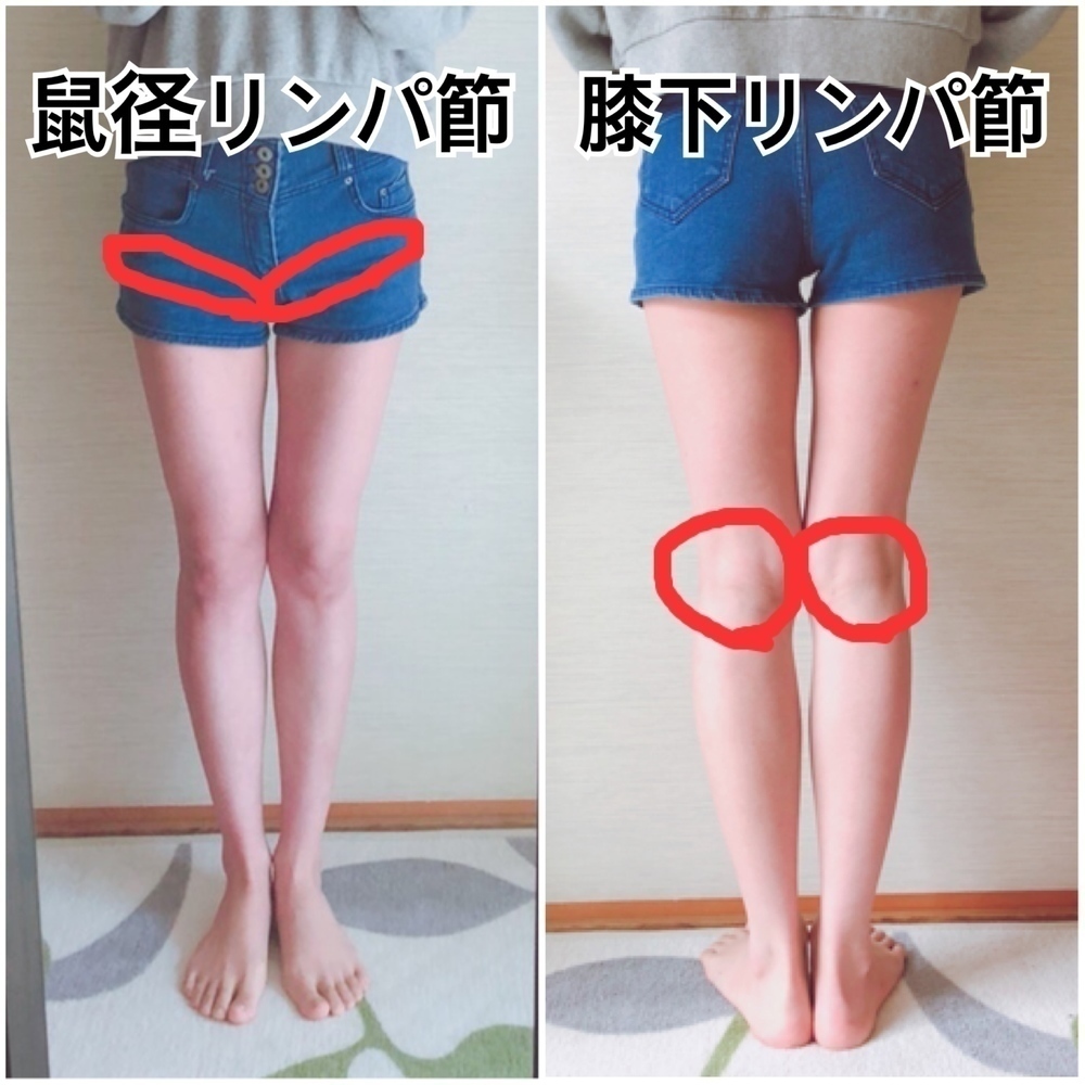61451c03aec50a2d