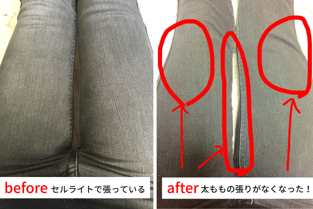 B7995c18ff6891ea